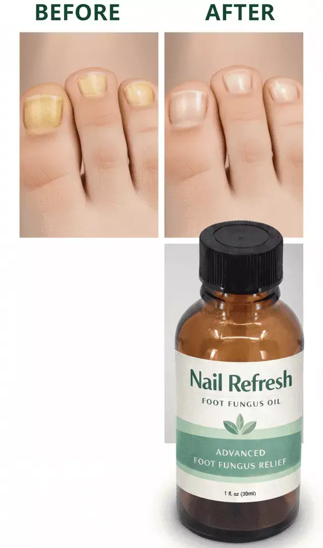 Nail Refresh oil being applied to toenail